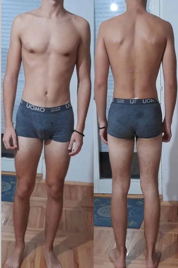 Body Type One, Muscles/Muscle Mass, Obesity, Skinny Fate