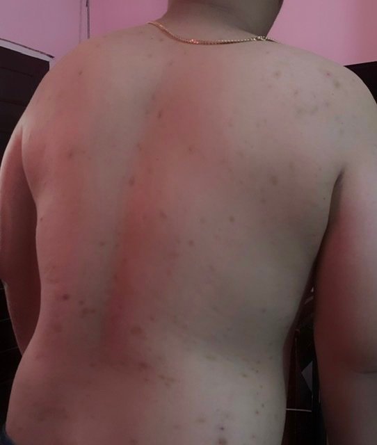 Research Participant 221 – Body Type Two (BT2) Male (Man), Millennial (Generation Y)