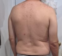 Fellow One Research Participant, The Four Body Types' Body Type Shape Quiz - Dan Bechtold - Body Type Two