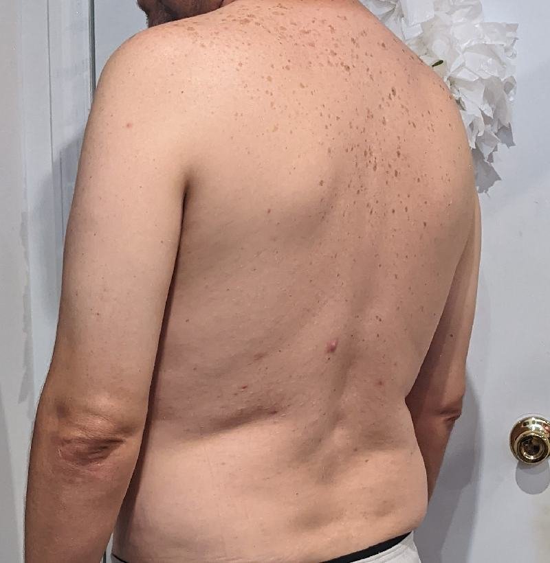 Research Participant 235 – Body Type Two (BT2) Male (Man), Generation X