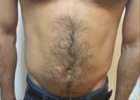 The Four Body Types' Free Body Type Shape Quiz Calculator Submission - Wael Almeshal - Fellow One Research