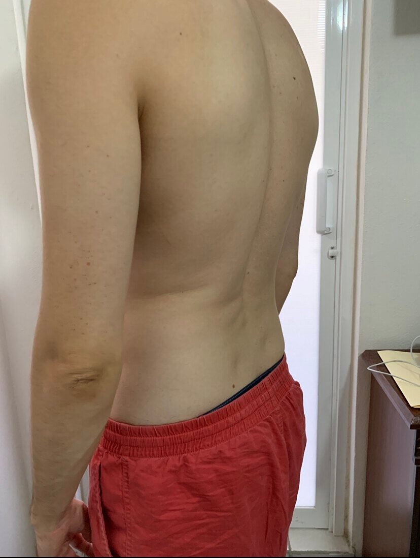 Research Participant 331 – Body Type Two (BT2) Male (Man), Millennial (Generation Y)