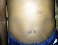 The Four Body Types Research Participant 315 - Andrew John Body Type Two - Fellow One Research Free Body Type Shape Quiz Calculator