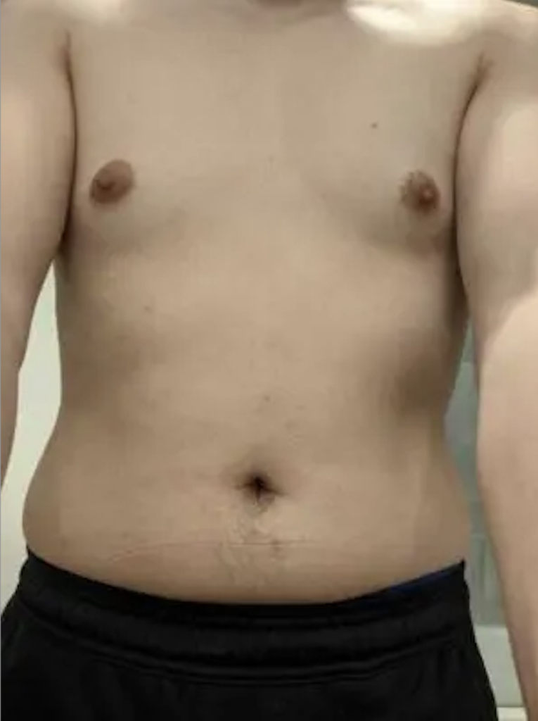 Scientific Body Type Quiz 360 - Front Abdominal