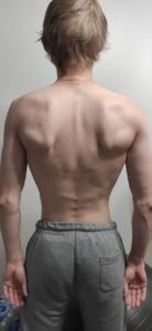 Fellow One Research Free Body Type Shape Quiz Calculator - Body Type Two Male- The Four Body Types Research Participant 362