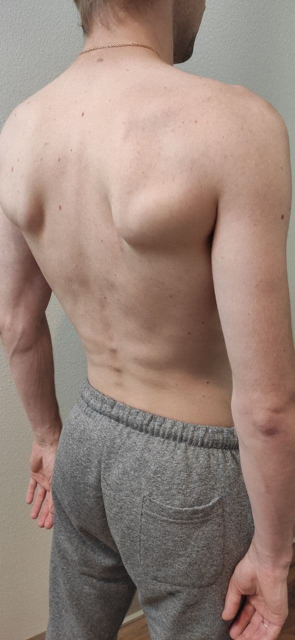 Research Participant 362 – Body Type Two (BT2) Male (Man), Millennial (Generation Y)