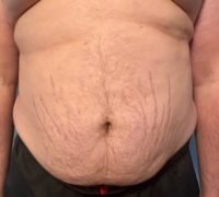 Body Type Two (BT2) Male - The Four Body Types Research Participant 378 - Fellow One Research Free Body Type Shape Quiz