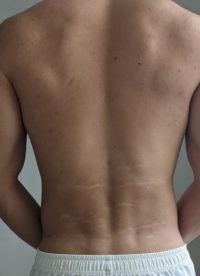 The Four Body Types Research Participant 377, Body Type One (BT1) Male - Fellow One Research Free Body Type Shape Quiz