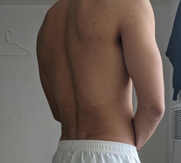 Research Participant 377 – Body Type One (BT1) Male (Man), Millennial (Generation Y)