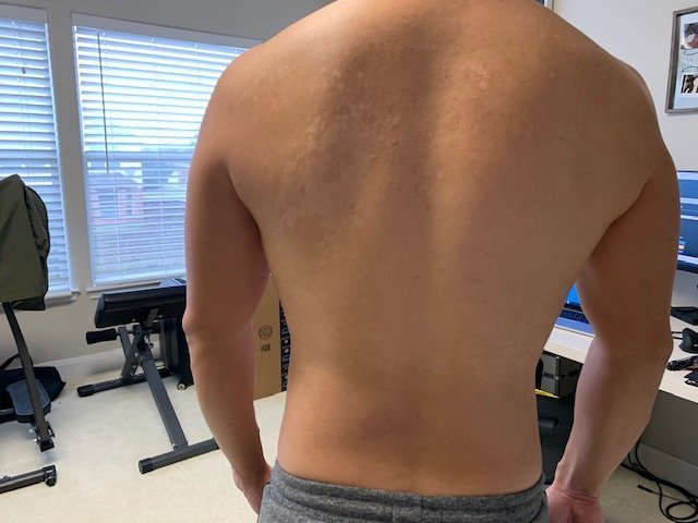 Body Type Two (BT2) Male - Fellow One Research Free Body Type Shape Quiz Calculator, The Four Body Types Research Participant 382