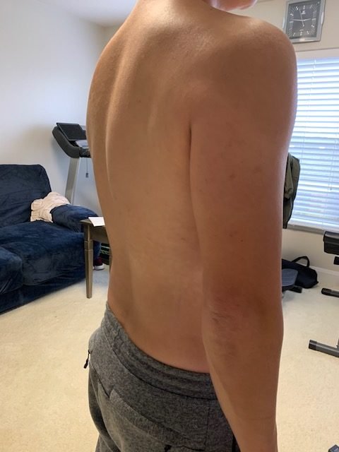 Research Participant 382 – Body Type Two (BT2) Male (Man), Millennial (Generation Y)