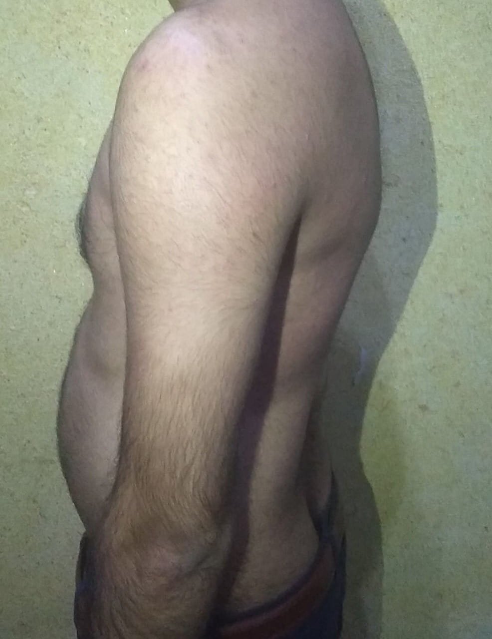 Research Participant 341 – Body Type Two (BT2) Male (Man), Generation Z