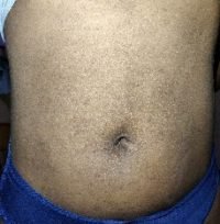 The Four Body Types Research Participant 373 - Body Type Two (BT2) Female - Fellow One Research Free Body Type Shape Quiz Calculator