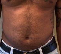 Body Type Two (BT2) Male - Fellow One Research Free Body Type Shape Quiz - The Four Body Types Research Participant 387