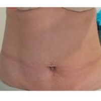 Body Type Two (BT2) Female - Fellow One Research Free Body Type Shape Quiz - The Four Body Types Research Participant 436