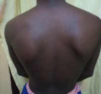 The Four Body Types Research Participant 425, Body Type One (BT1) Male - Fellow One Research Free Body Type Shape Quiz Calculator