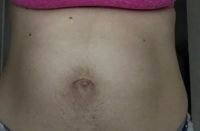 Body Type Three (BT3) Female - Fellow One Research Free Body Type Shape Quiz Calculator - The Four Body Types Research Participant 431