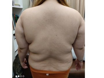 The Four Body Types Research Participant 482, Body Type Four (BT4) Female - Fellow One Research Free Body Type Shape Test