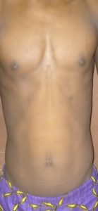 Body Type One (BT1) Male - The Four Body Types Research Participant 480 - Fellow One Research Free Body Type Shape Quiz