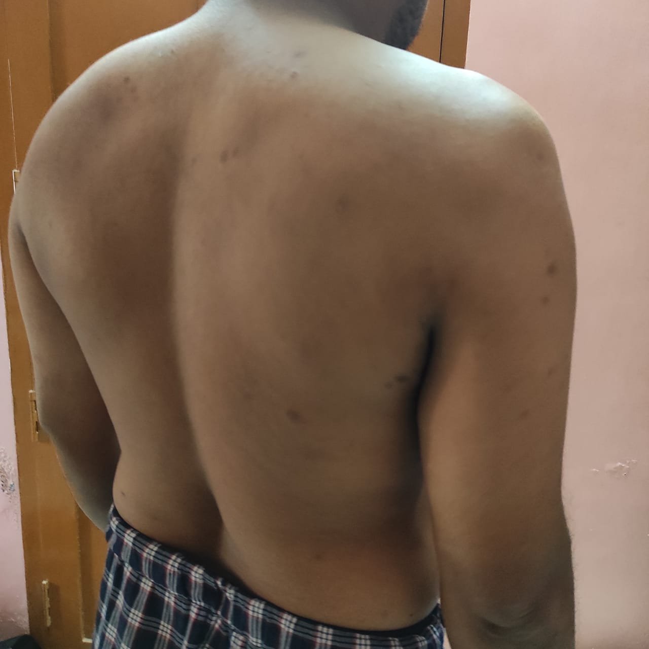 Research Participant 474 – Body Type Two (BT2) Male (Man), Generation X