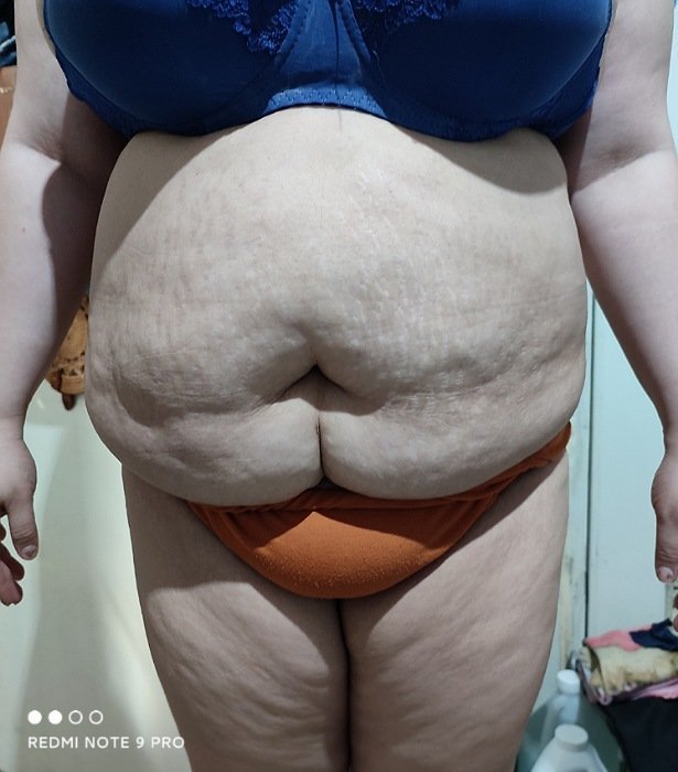 Body Type Four (BT4) Female - Fellow One Research Free Body Type Shape Test Calculator - The Four Body Types Research Participant 482