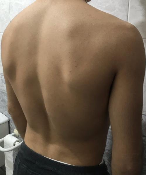 Research Participant 534 – Body Type One (BT1) Male (Man), Generation Z