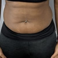 Body Type Two (BT2) Female - Fellow One Research Free Body Type Shape Quiz - The Four Body Types Research Participant 493