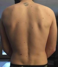 The Four Body Types Research Participant 496, Body Type One (BT1) Male - Fellow One Research Free Body Type Shape Test