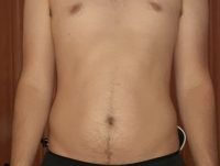 The Four Body Types Research Participant 525, Body Type Two (BT2) Male - Fellow One Research Body Type Shape Test/Quiz