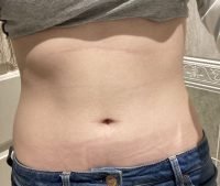 Body Type Two (BT2) Female - Fellow One Research Body Type Shape Test - The Four Body Types Research Participant 559