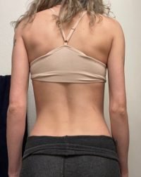 The Four Body Types Research Participant 581, Body Type One (BT1) Female - Fellow One Research Body Type Shape Quiz/Test