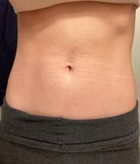 Body Type One (BT1) Female - Fellow One Research Body Type Shape Test - The Four Body Types Research Participant 581