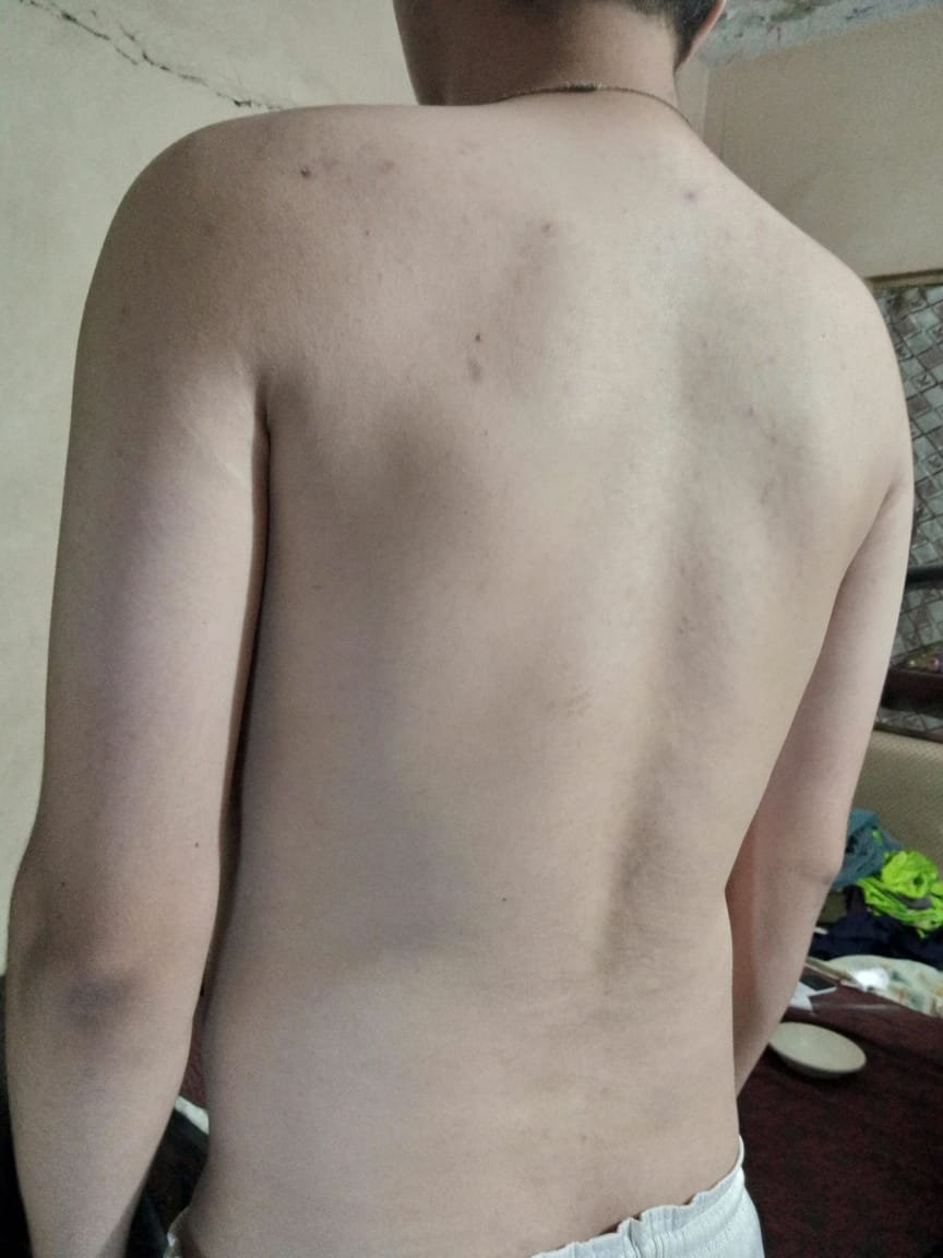 Research Participant 571 – Body Type Two (BT2) Male (Man), Generation Z