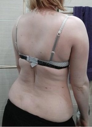 Body Type Test (Quiz) 650 – Body Type Three (BT3) Female (Woman), Millennial (Generation Y)