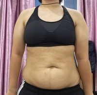 Body Type Three (BT3) Female - Fellow One Research Body Type Shape Test - The Four Body Types Research Participant 669