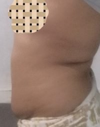  Body Type Shape Test - The Four Body Types, Body Type Three (BT3) Female - Fellow One Research Participant 627