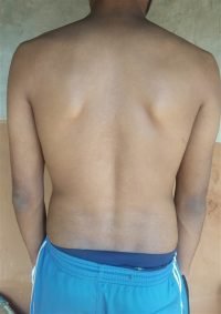 The Four Body Types Research Participant 633, Body Type One (BT1) Male - Fellow One Research Body Type Shape Quiz/Test