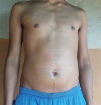 Body Type One (BT1) Male - Fellow One Research Body Type Shape Test - The Four Body Types Research Participant 633