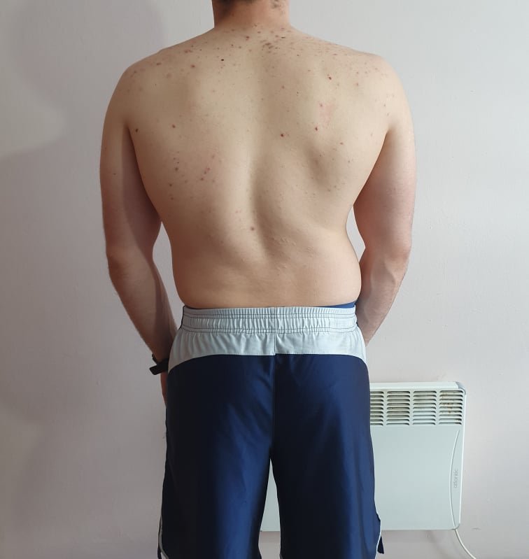 The Four Body Types Research Participant 675, Body Type Two (BT2) Male - Fellow One Research Body Type Shape Quiz/Test