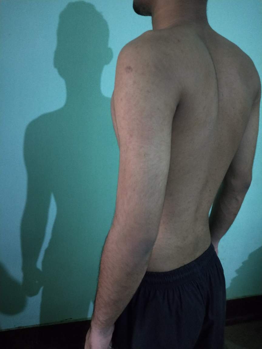 Body Type Test (Quiz) Results 718 – Body Type One (BT1) Male (Man), Generation Z