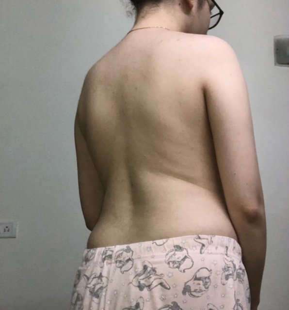 Body Type Test (Quiz) Results 725 – Body Type Two (BT2) Female (Woman), Generation Z