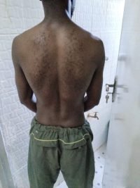 The Four Body Types Research Participant 701, Body Type One (BT1) Male - Fellow One Research Body Type Shape Quiz/Test