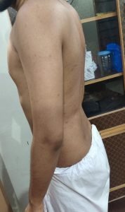 Free Body Type Shape Quiz Calculator, The Four Body Types, Fellow One Research Participant 706, Body Type Two (BT2) Male