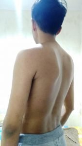 Body Type Test/Quiz (Male/Man) Results 773 - Fellow One Research Participant, The Four (4) Body Types Body Type One (BT1)