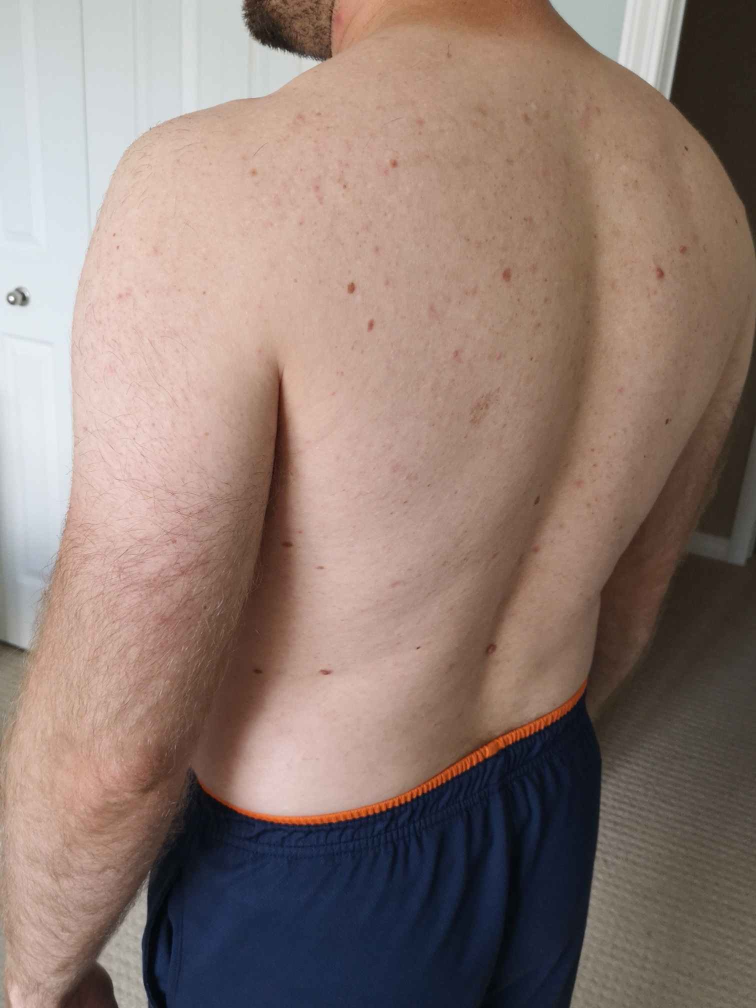 Body Type Test (Quiz) Results 797 – Body Type Two (BT2) Male (Man), Millennial (Generation Y)