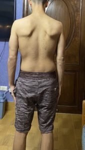 Body Type Two (BT2), Body Type Quiz (Male/Men) Results 756 - Fellow One Research Participant - The Four Body Types