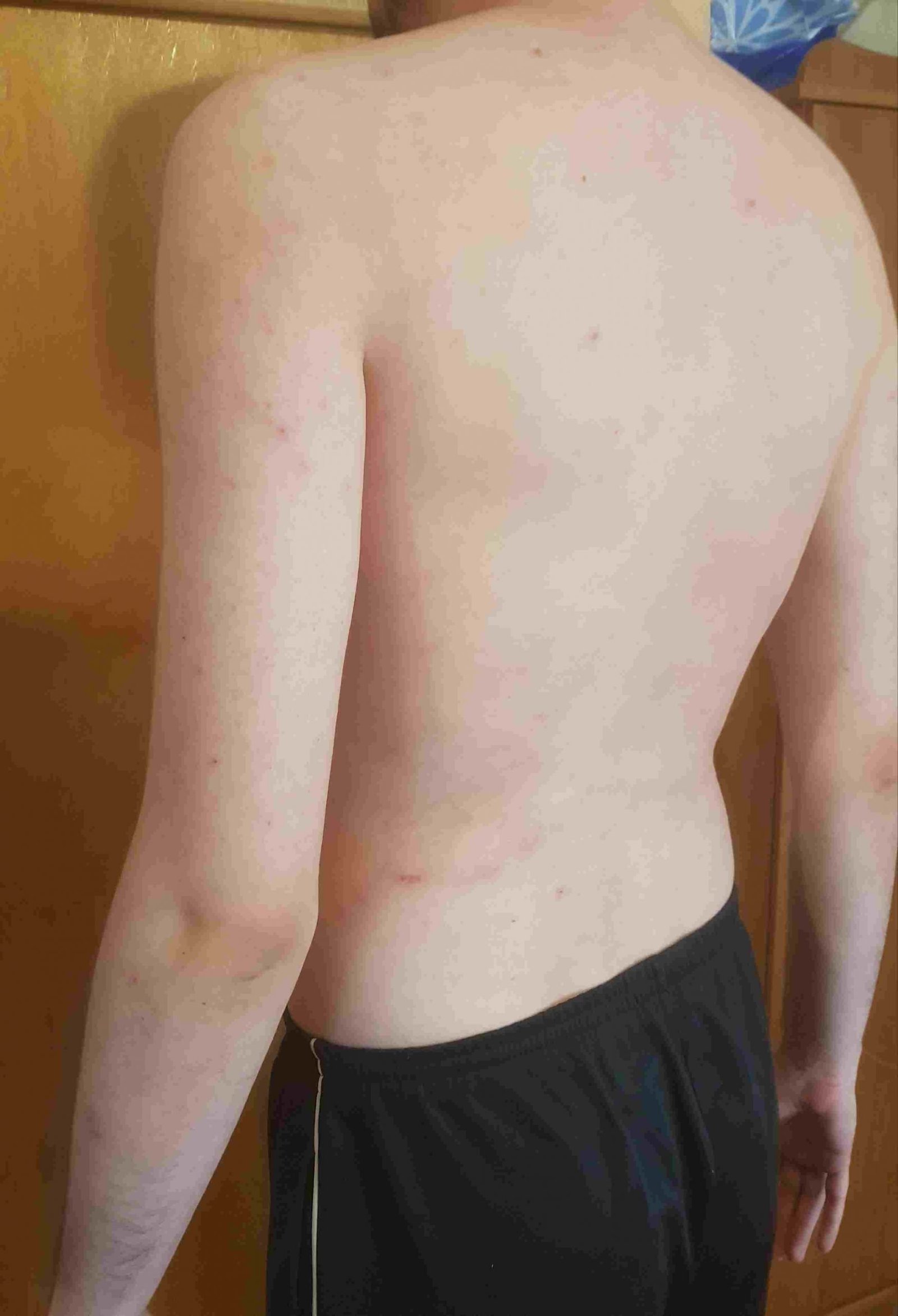 Body Type Test (Quiz) Results 776 – Body Type Two (BT2) Male (Man), Millennial (Generation Y)