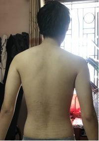 Body Type Two (BT2), Body Type Test/Quiz (Man/Male/Men) Results 888 - Fellow One Research, The Four Body Types