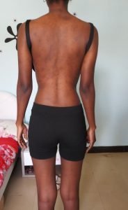 The Four (4) Body Types, Body Type Quiz (Woman/Women/Female) Results 1037 - Body Type One (BT1), Fellow One Research Participant Test