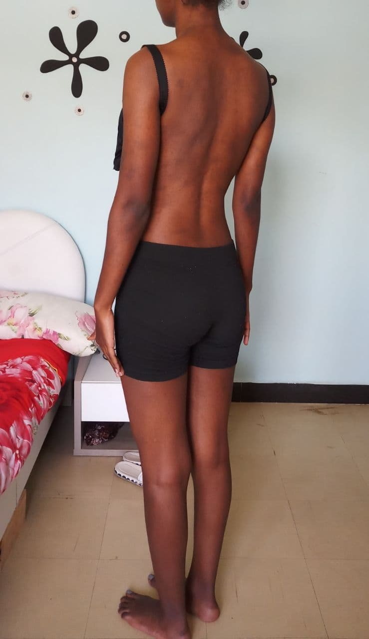 Body Type Test (Quiz) Results 1037 – Body Type One (BT1) Female (Woman), Millennial (Generation Y)